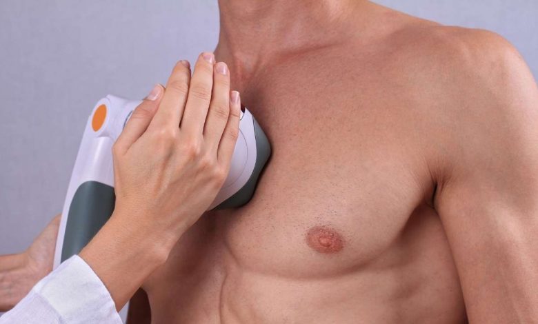 Laser hair removal treatment
