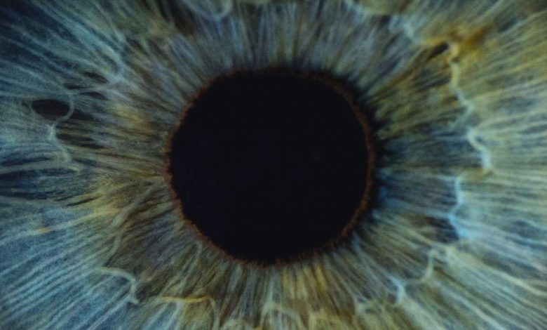 Vision