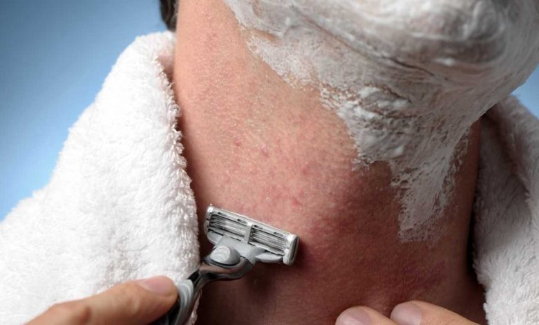 Razor Burn