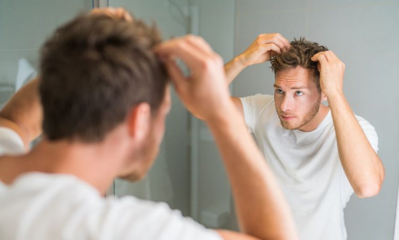 Hair Loss