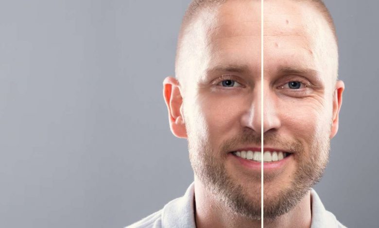 Cosmetic Procedure