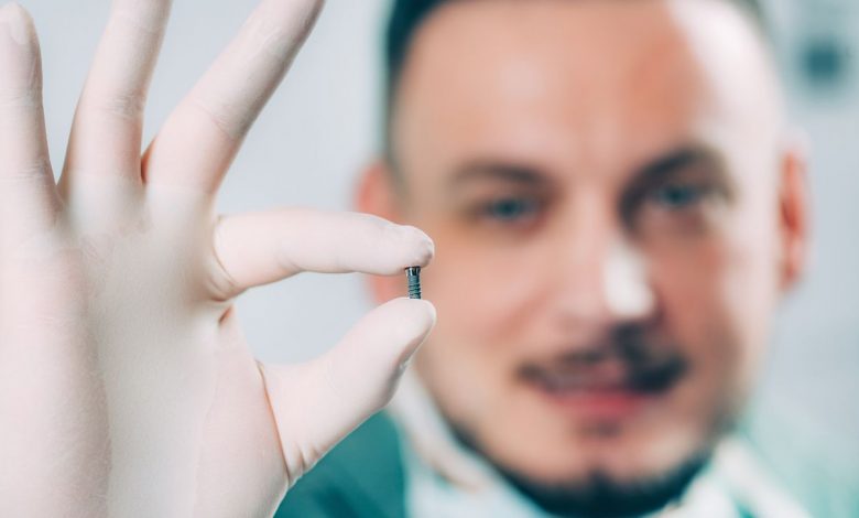Dental Implants