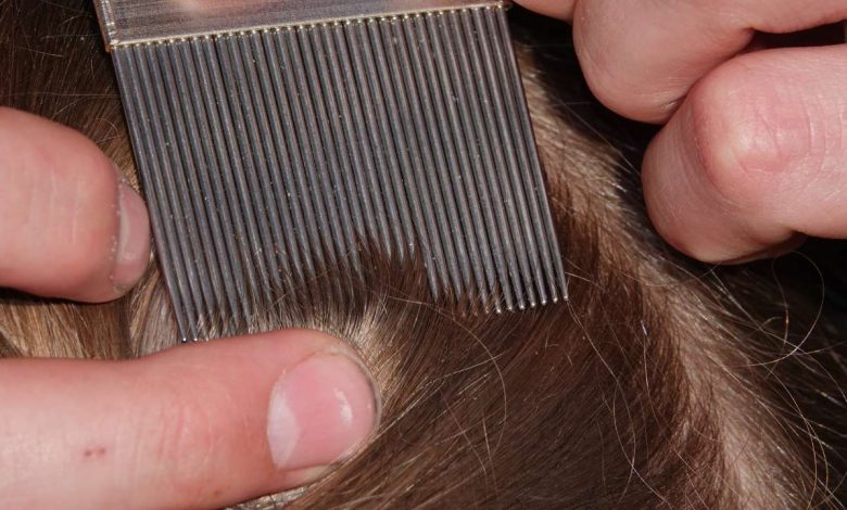 Lice in hair