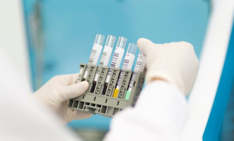 Public Cord Blood Banking