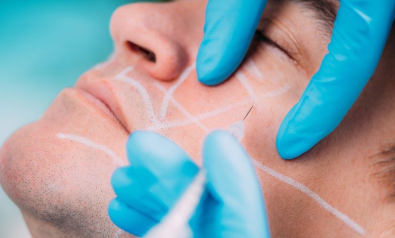 collagen-stimulating injections men