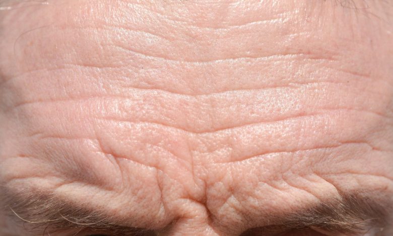 Aging signs