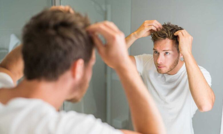 guy facing Hair Loss