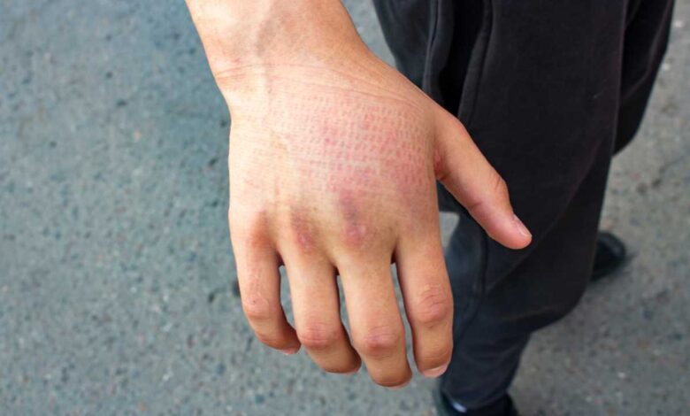 injured guy