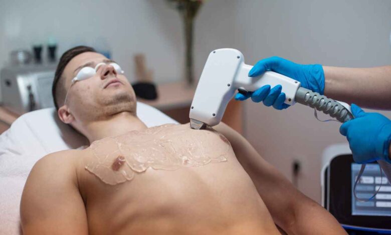 removing a mans chest hair with laser