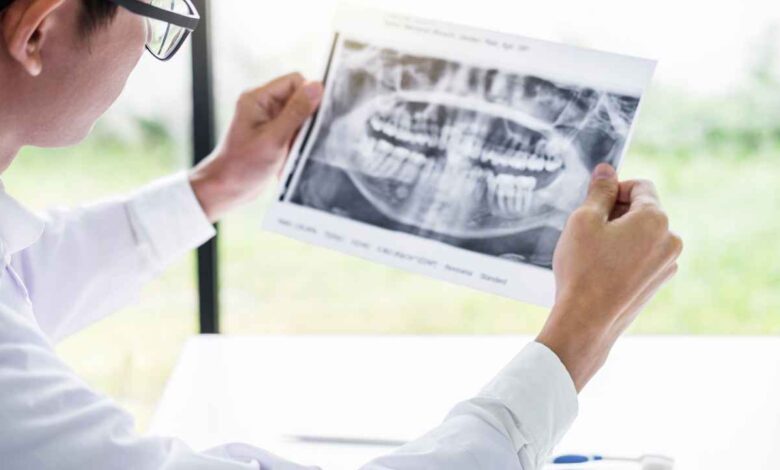 male doctor looking at dental xray