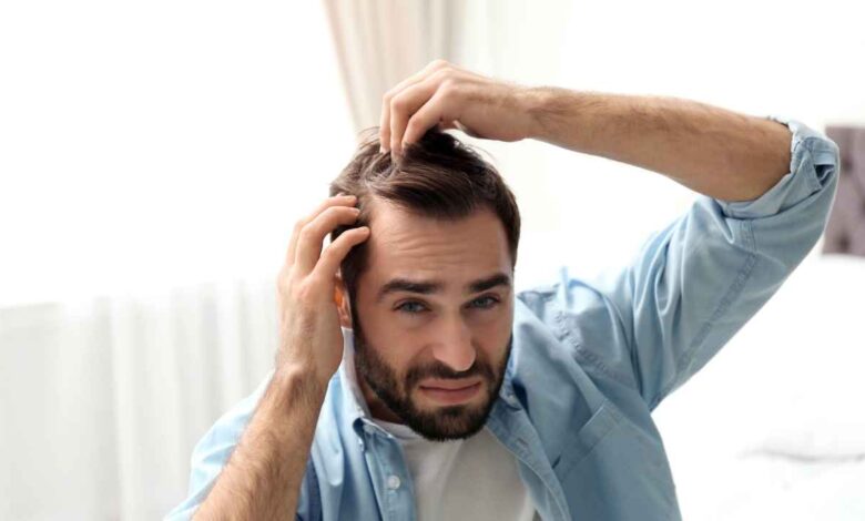 a guy concerned about his Thinning Hair