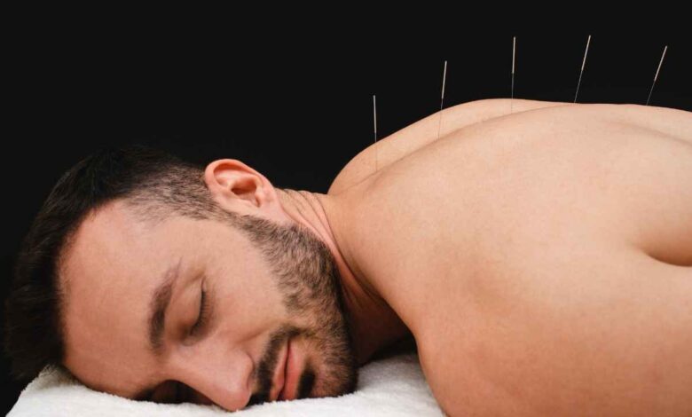 man during Acupuncture procedure